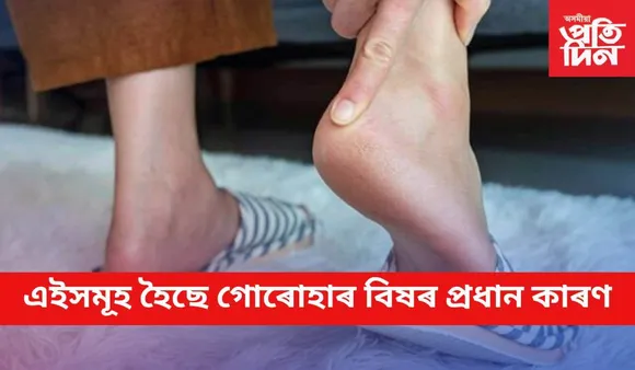 কেতবোৰ বিশেষ দিশত সৰ্তক হ’লেই কেতিয়াও নহয় গোৰোহাৰ বিষ