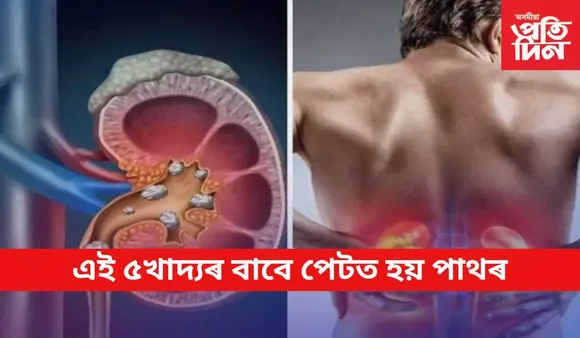 আজিৰে পৰা এইবোৰ খাদ্য নাখাব