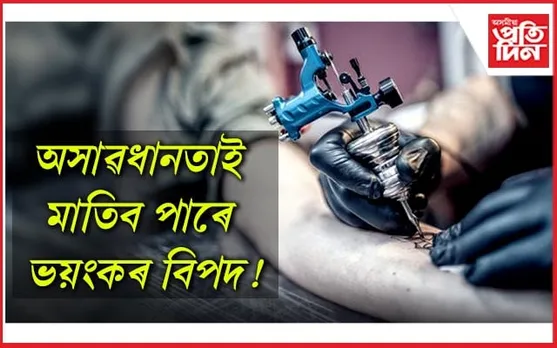 সাৱধান : টাটু আঁকি এইচ আই ভিত আক্ৰান্ত কুৰিজন