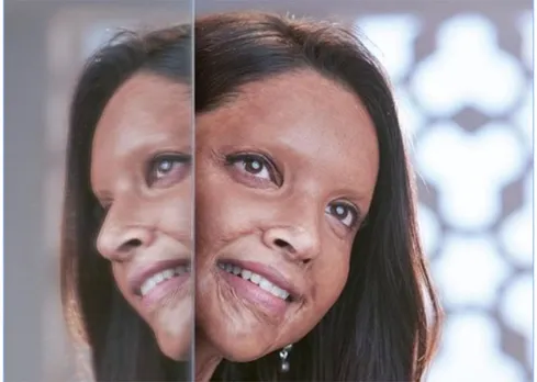 আহি আছে ‘ছপাক’, এচিড আক্ৰমণৰ বলি হোৱা যুৱতীৰ চৰিত্ৰত দীপিকা পাডুকন…