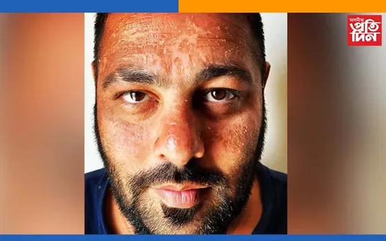 কি হৈছে বাদশ্বাহৰ, বলীউডৰ ৰেপাৰজনৰ মুখৰ এনে ৰূপে হতভম্ব কৰিছে তেওঁৰ অনুৰাগীক…