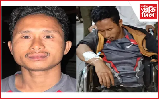 মৰিগাঁও আৰক্ষীৰ গুলীত আহত কুখ্যাত বাইক চোৰ…