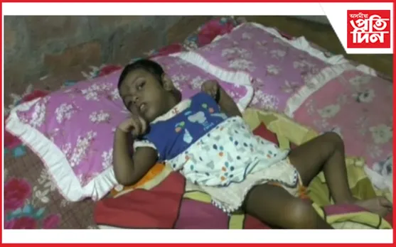 এক অচিন ৰোগত পৰি বিছনাত ছটফটাই আছে এটি কনমানি…