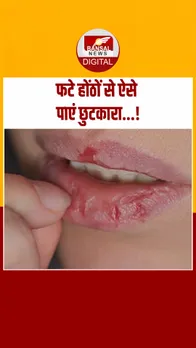 फटे होंठों से ऐसे  THUMB