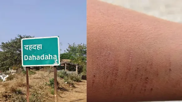 Dhamtari Students Hand Cutting Incident