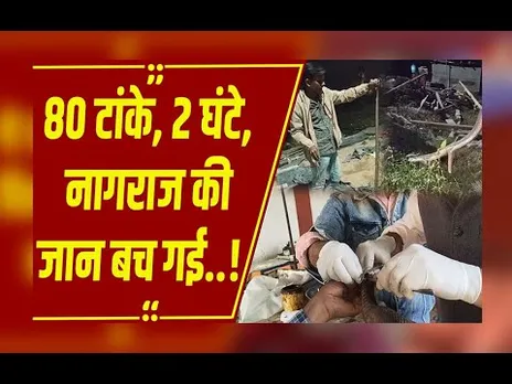 जेसीबी से घायल नागराज की सर्जरी: डॉक्टर ने 80 टांके लगाकर दी नई ज़िंदगी!
