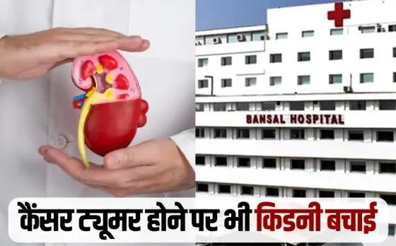 Bhopal: बंसल हॉस्पिटल में किडनी बचाकर निकाला 5.5 सेंटीमीटर का कैंसर ट्यूमर, महानगरों से आधे खर्च में ठीक हुआ युवा मरीज