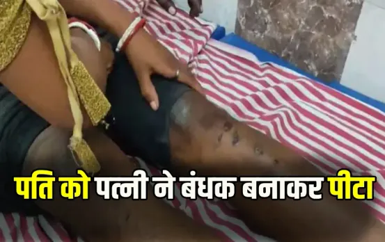 CG Surajpur Acid Attack