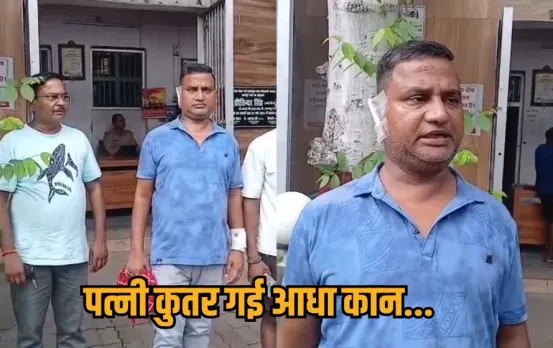 UP kanpur-wife-bites-husband-half-ear-domestic-violence-fir hindi news zxc