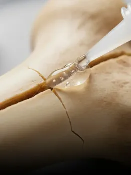 Bone Glue China bone 2 china hindi news