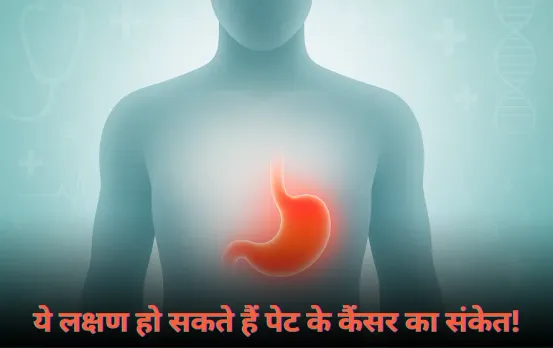 Stomach Cancer Symptoms: साधारण लगने वाले ये लक्षण हो सकते हैं पेट के कैंसर का संकेत, अनदेखा करने की गलती न करें