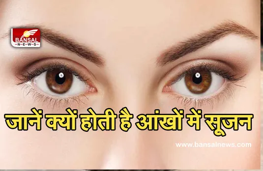 Health Tips : अगर आपकी आंखों में भी होती है सूजन, जानें क्या हैं कारण