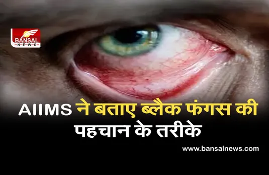 ब्लैक फंगस के लक्षणों को पहचानने के लिए AIIMS ने बताए तरीके, जानें गाइडलाइन के निर्देश