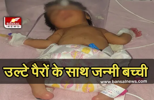 Breaking News: उल्टे पैरों के साथ जन्मी बच्ची, नजारा देख अस्पताल छोड़ भागे माता-पिता