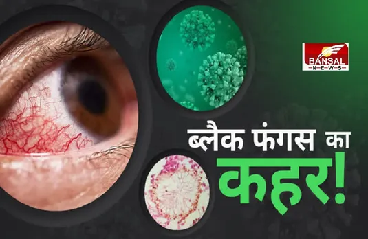 Black Fungus: देश में कोरोना के बाद ब्लैक फंगस का कहर जारी, जानिए किस राज्य में कितने हैं मरीज