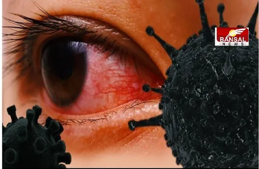 Black Fungus: कोरोना से जूझते लोगों में ब्लैक फंगस का बड़ा खतरा, इस सरकार ने इसे घोषित किया महामारी