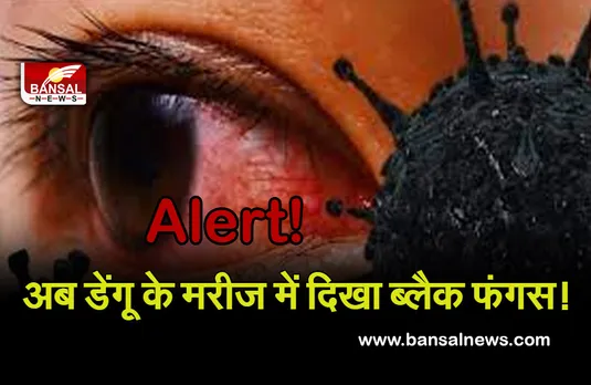 Black Fungus : Alert! अब कोरोना नहीं, डेंगू के मरीज में दिख रहा ब्लैक फंगस, प्रदेश के इस शहर में मिला नया केस