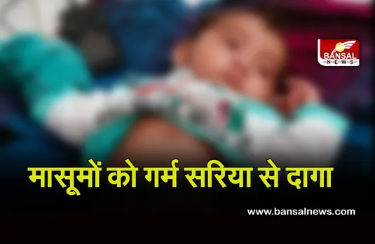 Breaking News: अंधविश्वास का दंश झेल रहे मासूम, तबीयत बिगड़ने पर गर्म सरिए से दागा, हालत बिगड़ी तो पहुंचे अस्पताल