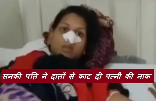 Crime News: सनकी पति की करतूत, दांतों से काट दी पत्नी की नाक, इस बात को लेकर हुआ था झगड़ा