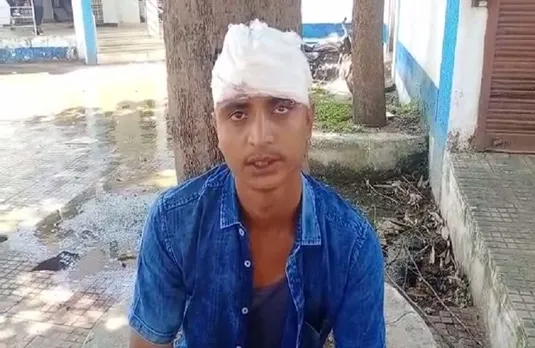 Shahdol News : बाइक पार्किंग को लेकर हुआ विवाद, युवक की सरेराह पिटाई,सिर पर दे मारा बोतल