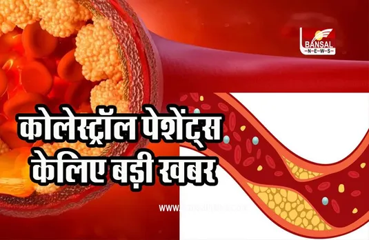 BAD CHOLESTEROL: इन तरीकों से होगा कोलेस्ट्रॉल मैनेज, नही लेनी पड़ेगी गोलियां