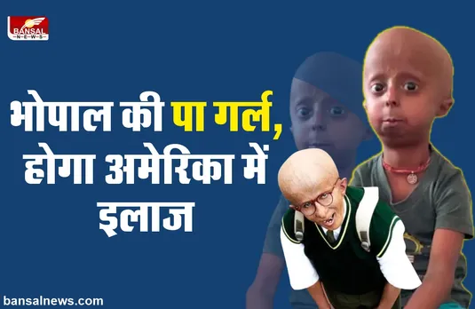 Bhopal Paa Girl : भोपाल में मिली 'पा' वाली बच्ची गुंजन, अब होगा अमेरिका में इलाज