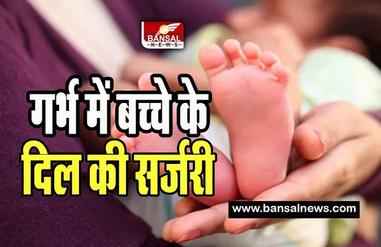 AIIMS Doctor Heart Surgery : धरती के भगवान का चमत्कार ! सिर्फ 90 सेकंड में मां के गर्भ में पल रहे बच्चे के दिल की सफल सर्जरी , जानिए खबर