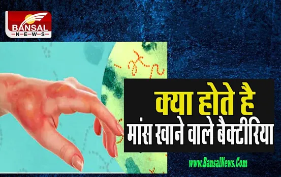 Kolkata Flesh-eating bacteria: क्या सच में होते है 'मांस खाने वाले बैक्टीरिया' ! ली 44 साल के शख्‍स की जान, जानिए कैसे करता है हमला
