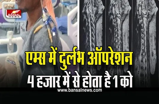 Bhopal AIIMS News : एम्स भोपाल में 2 फीट लंबे, साढ़े 4 किलो वजनी दुर्लभ ट्यूमर का सफल ऑपरेशन