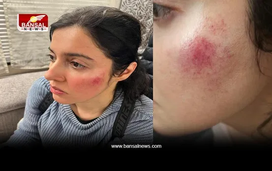 शूटिंग के दौरान बुरी तरह घायल हुईं Divya Khosla Kumar, एक्ट्रेस ने लिखा- 'शो मस्ट गो ऑन'