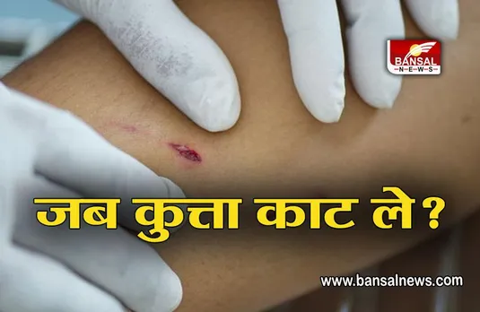 DOG BITE: क्या करें जब कुत्ता काट ले? जानें उपचार