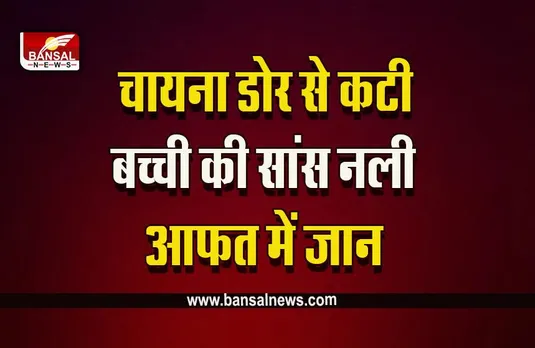 Durga China Dor News : चायना डोर बनी सांसों की डोर की दुश्मन, गले में फंसी , 5 साल के बच्चे की कटी सांस नली