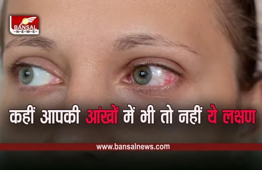 Conjunctivitis: ‘कंजंक्टिवाइटिस’ फैलने के बाद लोंगडिंग जिले में स्कूल बंद, ऐसे करें संक्रमण से बचाव