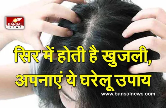 Itchy Scalp Home Remedies (Hair Care) : गर्मियों में 'सिर की खुजली' को दूर करने के लिए अपनाएं ये 7 घरेलू उपाय