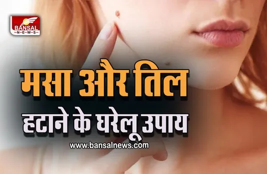 Home Remedies Of Moles Removal : क्या आपको भी हैं अनचाहे तिल और मस्से, यहां जानें हटाने के घरेलू उपाय, लगाने का तरीका