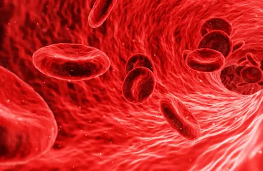 Jabalpur News: सिकल सेल एनीमिया के 63 मरीज मिले, विशेषज्ञ डॉक्टर्स की निगरानी में इलाज जारी