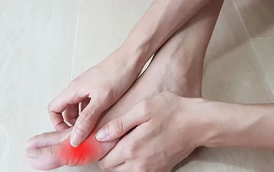 Home Remedies For Joint Pain: जोड़ों में जमा यूरिक एसिड को साफ कर देते हैं ये 5 घरेलू नुस्खे