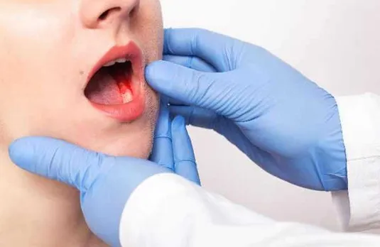 Heart Attack Signals: क्या मुंह की लार देती है दिल की बीमारी का संकेत, जानें साइंटिस्ट की ये रिसर्च