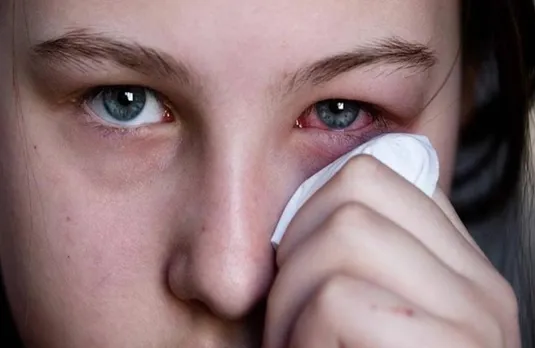 Eye Flu Infection: क्या संक्रमित व्यक्ति की आँखों में देखने से फैलता है संक्रमण, जानिए स्वास्थ्य एक्सपर्ट की राय