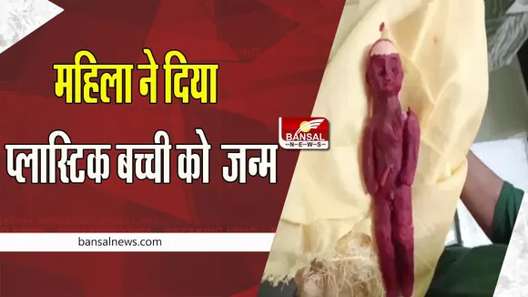Plastic Child Delivery: चौंकिए ! जब डिलीवरी होने पर महिला को हुई प्लास्टिक सी बच्ची , फिर क्या हुआ पढ़ें इस खबर में