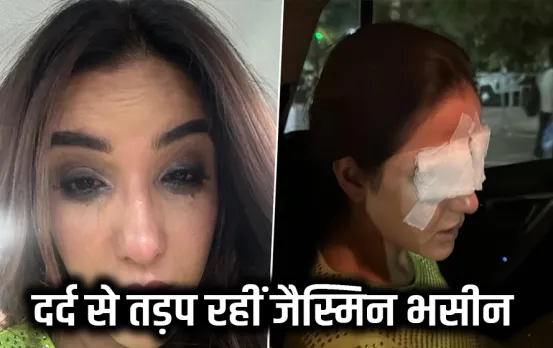 Jasmine Bhasin Eye Cornea: जैस्मीन भसीन को कांटेक्ट लेंस की वजह से आँख से दिखना हुआ बंद, एक्ट्रेस ने शेयर की तस्वीरें