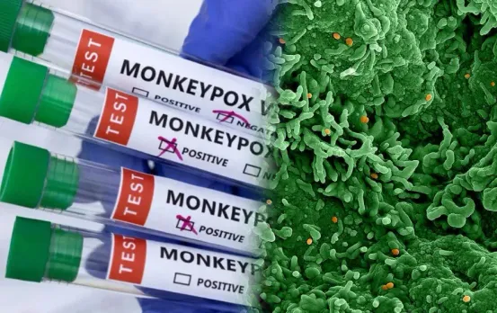 Monkeypox Virus