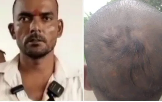 थाने में युवक को पुलिस ने बूरी तरह पीटा: चोटी उखाड़ी जनेऊ तोड़ा, समाज के लोगों ने किया विरोध, एसपी से कार्रवाई की मांग की