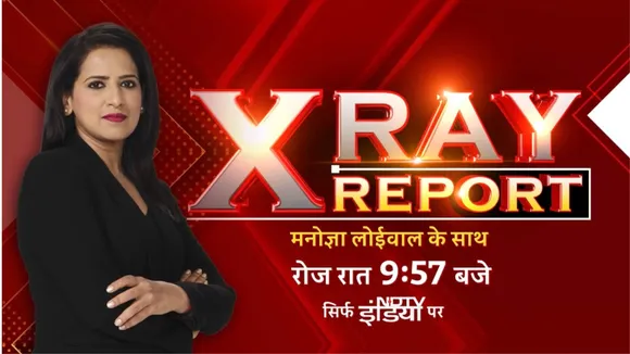 X ray report 
