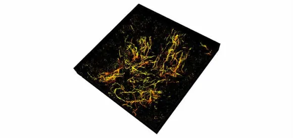 3D Imaging nanoscope