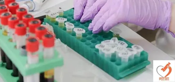 MyLabs Coronavirus test kit