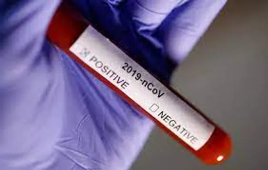 Corona virus