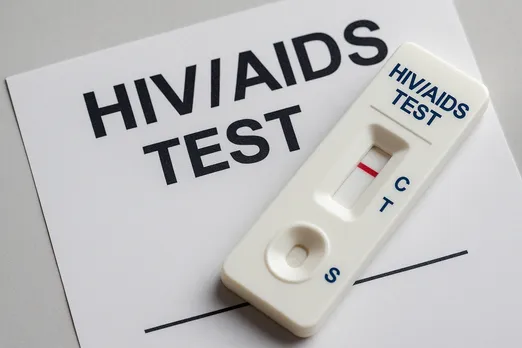 HIV AIDS