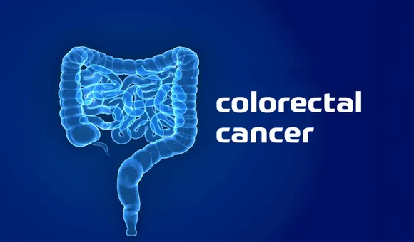 cancer