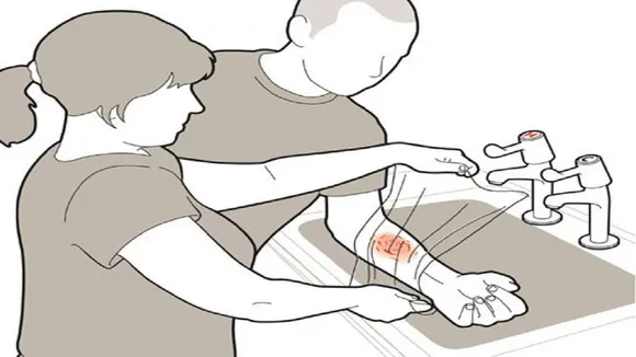 prevention